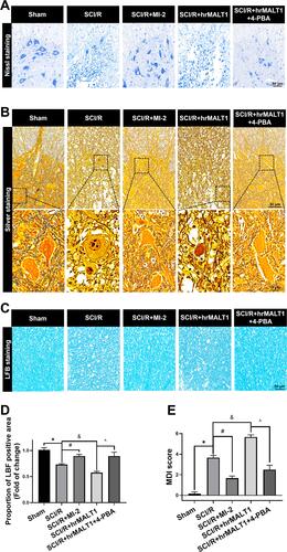 Figure 10 Neuronal loss and hindlimb locomotor function evaluation in rats. (A) Nissl staining and (B) silver staining were used to detect neuronal damage in the anterior horn of spinal cord. (C, D) LFB staining was used to detect demyelination of the spinal cord. (E) Neurological scores accessed by motor deficit index (MDI) scale. Data are presented as the mean ± SEM. n = 6 per group. *P < 0.05 vs sham group, #P < 0.05 vs SCI/R group, &P < 0.05 vs SCI/R group, ^P < 0.05 vs SCI/R + hrMALT1 group.