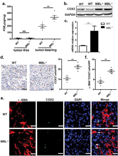 Figure 5. MBL deficiency correlates with elevated COX-2 expression and PGE2 production.(a) The liver homogenate was collected to detect the PGE2 production by ELISA. COX-2 protein (b) and its mRNA expression (c) in tumor tissues were analyzed by immunoblotting and quantitative RT-PCR, respectively. (d) Analysis of COX-2 positive cells in tumor tissues by immunohistochemistry (each dot represents the average of 10 HPFs). (e) Immunofluorescence double staining of COX-2 (green) and α-SMA+ cells (red) and (f) quantification of α-SMA+ cells with COX-2 overexpression (white arrow) in tumor tissues of tumor-bearing mice. Nuclei were counterstained with DAPI (blue). Scale bars, 25 μm. Each dot represents the average percentages of cells indicated by arrow on 10 HPFs. Data are presented as means ± SEM (horizontal lines). *, P < 0.05; **, P < 0.01. The data representative of more than three independent experiments with similar results are shown.