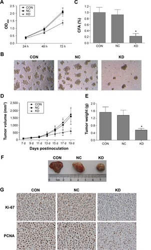 Figure 2 B7-H3 knockdown inhibits tumor proliferation in vitro and in vivo.