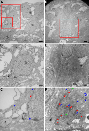 Figure 5. Transmission electron microscopy (TEM) of lens epithelial-like cells revealed retention of cellular organelles in FYCO1 (c.2206C>T) knock-in (KI) human embryonic stem cell (hESC)-derived lentoid bodies on differentiation day 25. (A–C) Wild type (WT) lentoid bodies show relatively fewer endoplasmic reticulum (ER; blue arrow), Golgi apparatus (GA; green arrow), and mitochondria (red arrow), in lens epithelial-like cells. (D–F) In contrast to WT, lens epithelial-like cells in FYCO1 KI hESC-derived lentoid bodies revealed an increased mass of ER, mitochondria, and GA. Note: Image magnifications: 6,000x (A, D), 12,000x (B, E), and 25,000x (C, F); Scale bars: 2 µm (A, D), 1 µm (B, E) and 500 nm (C, F). Panels B and C and panels E and F are enlarged images of the boxed areas (B and E: solid lines; C and F: broken lines) in panels A and D, respectively.