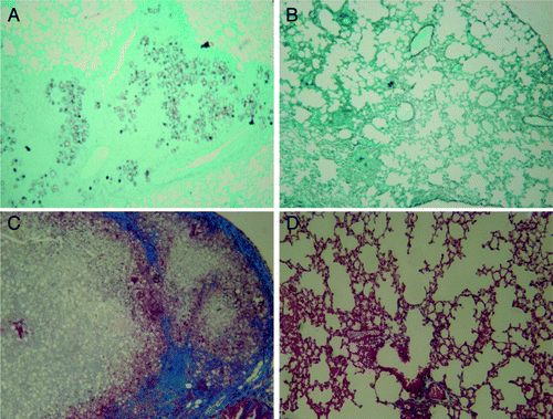 Figure 1. Histopathology of lungs from intratracheally infected BALB/c mice. Animals were infected with P. brasiliensis Pb18 for 30 d and treated with pcDNA3-P10 and pORF-mIL-12. (A and C) Untreated infected mice; (B and D) Infected mice immunized with plasmids pP10 and pIL-12 (A and B). Gomori staining showing yeast cells embedded in the lung infiltrate and clearing with plasmid treatment; (C and D) Masson’s trichrome staining showing blue collagen fibers, a granuloma and great number of yeast cells, and the effect of plasmid treatment. Original magnification, 100X.