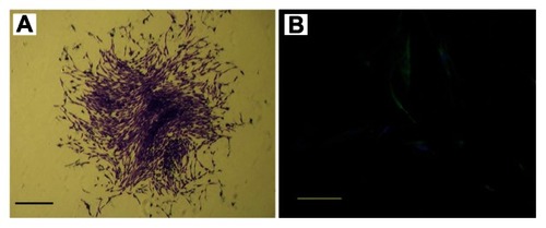 Figure 1 Characterization of human periodontal ligament stem cells. (A) Cell clusters derived from the periodontal ligament formed a single colony and were stained with 0.1% toluidine blue (scale bar: 100 μm). (B) Cultured periodontal ligament stem cells exhibited positive staining for STRO-1 (green fluorescent signals; blue signals nuclei) (scale bar: 50 μm).
