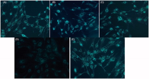 Figure 3. A–E respectively on behalf of the blank control group; 6.25 µg/mL SN50 group; 12.5 µg/mL SN50 group; 25 µg/mL SN50 group and 50 µg/mL SN50 group.