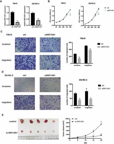 Figure 2. Silencing of NNT-AS1 restrains ccRCC proliferation and metastasis. A Verification of NNT-AS1 siRNA efficiency by qRT-PCR analysis. B Effect of NNT-AS1 knockdown on ccRCC cells proliferation. C and D Effect of NNT-AS1 knockdown on ccRCC metastasis. E Effect of NNT-AS1 knockdown in in vivo xenografted animal model. *P < 0.05, ** P < 0.01, ***P < 0.001