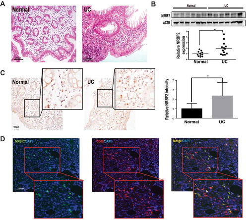 Figure 7. NRBF2 expression is upregulated in the colon of UC patients. (A) Representative images of the HE staining of clinically normal and active UC human colon biopsies (n = 3). Scale bar: 200 μm. (B) Western blotting results in the NRBF2 expression in normal and active human UC human colon tissue. Below, Quantification of the western blotting results for relative NRBF2 expression that normalized with ACTB in normal and active UC human colon tissue (n = 11–13). Mean ± S.D. (C) Immunohistochemistry images of the NRBF2 staining of normal and active UC human colon samples (violets, nuclei; brown, NRBF2; n = 3 samples). Right, Quantification of IHC staining results of NRBF2 in normal and active UC human colon. Scale bar: 100 μm. (D) Colocalization of NRBF2 and CD68 in active human UC colon samples (n = 3 samples; red, CD68; green, NRBF2). Scale bar: 100 μm. Mean ± S.D. Data in B and C. were analyzed via an unpaired Student’s t-test. *P < 0.05
