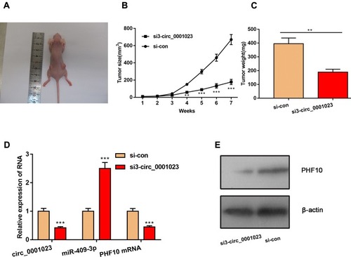 Figure 7 Knockdown of circ_0001023 can impede the growth of GC cells in vivo. (A) The representative diagram of tumorigenesis in nude mice was shown. (B, C) Knockdown of circ_0001023 could restrain the growth of tumors in vivo. (D) Knockdown of circ_0001023 inhibited the expressions of circ_0001023 and PHF10 mRNA in mice tumor tissues and upregulated the expression of miR-409-3p. (E) Western blot showed that knockdown of circ_0001023 repressed PHF10 protein expression. ** and *** represent p<0.01 and p< 0.001, respectively.