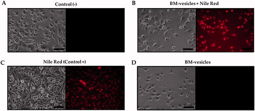Figure 10. BM-vesicles penetration in cells. Phase-contrast microscopy and fluorescence microscopy from SK-MEL-28 culture (A) and after incubation with BM-vesicles labelled with Nile Red (NR) (B), with free NR (positive control) (C), and with BM-vesicles without NR (D). Scale bar = 100 mm.