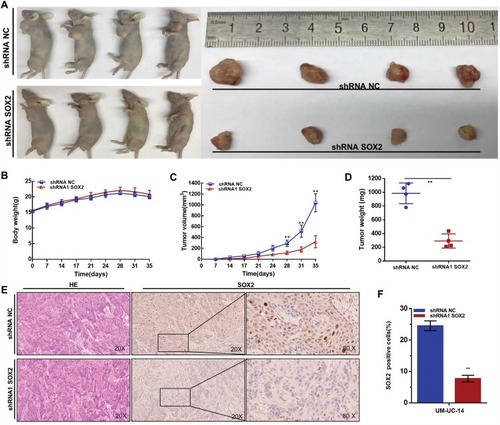 Figure 5 Effect of SOX2 on the tumorigenicity of UTUC cells. (A): Tumors collected from mice are shown. (B): The weights of nude mice in different groups were measured and analyzed. (C): Tumor volume curves of different groups were measured and analyzed. (D): Tumor weights in different groups were measured and analyzed. Knocking down SOX2 expression inhibited the tumorigenicity of UTUC cells in vivo. (E and F): shRNA-SOX2 decreased SOX2 expression in UTUC cells in vivo. Data are shown as the mean ± SD. **p < 0.01.