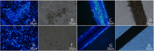 Figure 2 Specimens from the skin lesion were subjected to direct microscopic examination. (A) a representative image of fungal hyphae and spores from the scalp scales on the top of head staining with calcofluor white under fluorescence microscope (original magnification, ×400); (B) represents the same field as A under the light microscopy. (C) a representative image for fungal hyphae and spores from hair in the rash area on the top of the head staining with calcofluor white under fluorescence microscope (original magnification, ×400); (D) represents the same field as C under the light microscope. (E) a representative image of fungal spores from the scalp scales on the occipital staining with calcofluor white under fluorescence microscope (original magnification, ×400); (F) represents the same field as (E) under the light microscopy. (G) a representative image for fungal spores from hair in the rash area on the occipital staining with calcofluor white under fluorescence microscope (original magnification, ×400); (H) represents the same field as G under the light microscope.