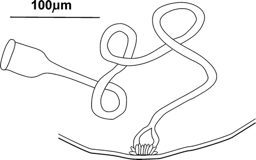Figure 4 Cernosvitoviella longiducta n. sp. male duct with a penial bulb.