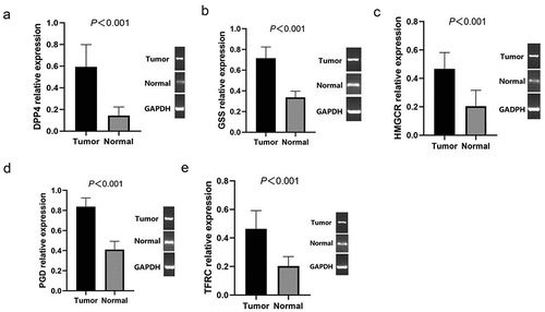 Figure 7. RT-qPCR detecting the mRNA expression levels of DPP4 (a), GSS (b), HMGCR (c), PGD (d), TFRC (e) in PTC and normal tissues