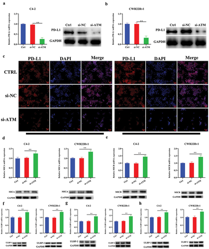 Figure 5. ATM promotes PD-L1 while concurrently suppressing NKG2D ligand expression in CRPC cells. a, b. the level of PD-L1 expression in ATM knockdown CRPC cell lines after co-culture with M2 macrophages. GAPDH was used for normalization. c. immunofluorescence stained with PD-L1 (red) in ATM knockdown CRPC cell lines after co-culture with M2 macrophages. Scale bar = 50 μm. d-h. NKG2D-activated ligands (MICA, MICB, ULBP-1, ULBP-2, and ULBP-3) were expressed in ATM knockdown CRPC cell lines after co-culture with M2 macrophages. GAPDH was used for normalization. Data are presented as the mean ± SD; n = 3; **P < .01. P-values were calculated by one-way ANOVA with post hoc Tukey’s multiple comparison analysis.