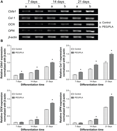 Figure 6 Gene expression profile of rat bone mesenchymal stem cells in osteogenic cultures. (A) Agarose gel electrophoresis result of the real-time polymerase chain reaction product shows the effects of the culture scaffold on gene expression on day 7, 14, and 21. (B) Quantitative analysis for Col I, Cbfa-1, OCN, and OPN expression was performed by Gene Expression Analysis for iCycler iQ® Real-Time PCR Detection System (Bio-Rad Laboratories, Hercules, CA); relative gene expression levels were normalized by the housekeeping gene, β-actin.Note: *Represents statistically significant difference (P < 0.05), n = 3.Abbreviation: PEG/PLA, poly(ethylene glycol)/polylactide.