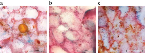 Figure 8. Light micrographs of cassumunar ginger rhizome samples: (a) untreated sample, (b) sample treated with HD for 5 h and (c) sample treated with SFME for 70 min (bar = 100 μm).