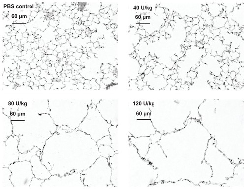 Figure 1 Photomicrographs of lungs 21 days after elastase instillation, stained with hematoxylin and eosin (magnification 200×). Representative sections after instillation of phosphate-buffered saline (PBS) control, 40 U/kg body weight, 80 U/kg, and 120 U/kg are shown.