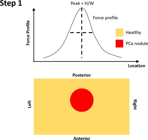 Figure A1. Step 1 – Identification of PCa nodule location along the left-right axis.