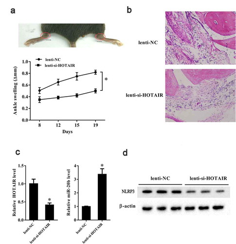 Figure 7. HOTAIR knockdown suppressed ankle swelling in a gouty arthritis mouse model. C57BL/6 mice were intra-articularly injected with 2 mg MSU in 10 μl PBS. After 24 h, lentivirus-mediated si-HOTAIR and si-control were intra-articularly injected into one ankle joint and contra-lateral ankle, respectively. Ten C57BL/6 mice were randomly divided into the following two groups: Lenti-NC group (n = 5) and Lenti-si-HOTAIR group (n = 5). A. Ankle swelling was measured at the 8th, 12th, 15th, 19th day using a precision caliper. B. HE staining of the joint tissue in the two groups (200X) and circles indicated the lymphocytes. C. LncRNA HOTAIR expression was down-regulated in the Lenti-si-HOTAIR group. C. miR-20b expression was up-regulated in the Lenti-si-HOTAIR group. D. Nlrp3 expression was down-regulated in the Lenti-si-HOTAIR group. *P< 0.05, compared with Lenti-NC