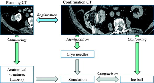 Figure 2. Overview of the annotation workflow for structure contouring, image registration, and needle identification. Image data sets are courtesy of Dr. Alex King, University Hospital Southampthon.