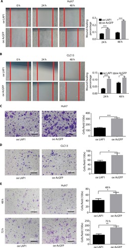 Figure 5 LAP1 inhibits the migration and invasion of HCC.Notes: (A and B) A wound-healing assay showed that cell motility was suppressed by LAP1 overexpression in Huh7 and CLC13 cells. Microscopic images were acquired at 0, 24, and 48 h after scratching the surface of a confluent layer of cells. (C and D) The in vitro migration ability of Huh7 and CLC13 cells infected with LAP1 was assessed using Transwell assays. Cells infected with AcGFP were used as a control. Scale bar, 200 µm. (E) Matrigel invasion assay was conducted to compare the cell invasion ability between LAP1-overexpressing and control Huh7 cells after 48- and 72-h infection. Invaded cells were fixed and stained with crystal violet, Scale bar, 200 µm. The number of invaded cells was calculated and is shown in the bar chart. All data are mean ± SD of three independent experiments (*P<0.05, **P<0.01, ***P<0.001, Student’s t-test).Abbreviations: LAP1, liver-enriched activator protein; oe, overexpression.