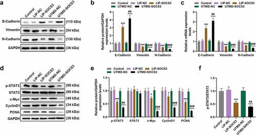 Figure 5. Effects of SOCS3 transfection with liposomes or UTMD on the expressions of EMT- and STAT3 pathway-related genes in BCSCs. (a-e) Effects concerning the transfection of SOCS3 into BCSCs with liposomes and UTMD on EMT-related molecules (E-Cadherin, N-Cadherin, Vimentin) and STAT3 pathway-related molecules (STAT3, CyclinD1, PCNA) were detected by RT-qPCR and Western blot as needed. Each experiment was repeated three times independently. GAPDH was set as control. *P < 0.05, ***P < 0.001 vs. LIP-NC; ^^^P < 0.001 vs. UTMD-NC; ##P < 0.01, ###P < 0.001 vs. LIP-SOCS3.