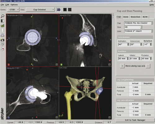 Figure 2. Evaluation using postoperative CT. Each angle is displayed on the screen.