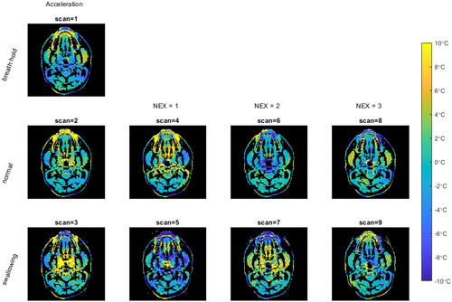 Figure 4. MRT maps for the temperature change of one unheated subject (volunteer #3, time point = 2) shows the qualitative differences between acquisitions. The rows are (from top to bottom): breath hold, normal free breathing and swallowing. The columns are (from left to right): acceleration, NEX = 1, NEX = 2, and NEX = 3.