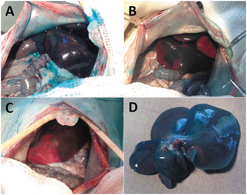 Figure 3. Non-perfused areas of liver tissue 2 h after transplantation of 100 (A), 500 (B) and 1000 (C) syngeneic pancreatic islets with ligation and excised liver after transplantation of 1000 syngeneic pancreatic islets without ligation of hepatic arteries (D) 2 min after application of patent blue intravital contrast dye. Without ligation, the contrast dye perfuses quickly into the temporally ischemic areas through the arterial circulation.