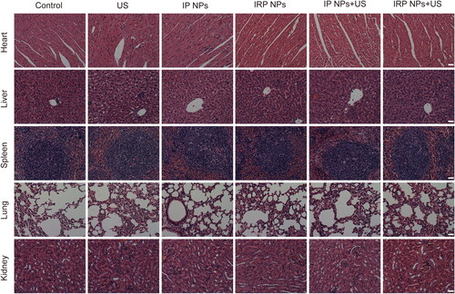 Figure 9. H&E staining of heart, liver, spleen, lung, and kidney after different treatments (scale bar: 50 µm).