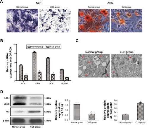 Figure 3 BMSCs derived from depressive rats had low osteogenic potential and autophagic level.