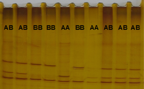 Figure 1. SSCP gel of different genotypes in control broiler.