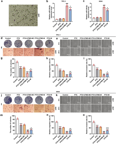 Figure 6. The effect of UTMD-mediated miR-144-5p overexpression on the miR-144-5p expression, proliferation, and invasion of PTX-induced TPC-1 and IHH4 cells was stronger than liposome-mediated miR-144-5p overexpression.