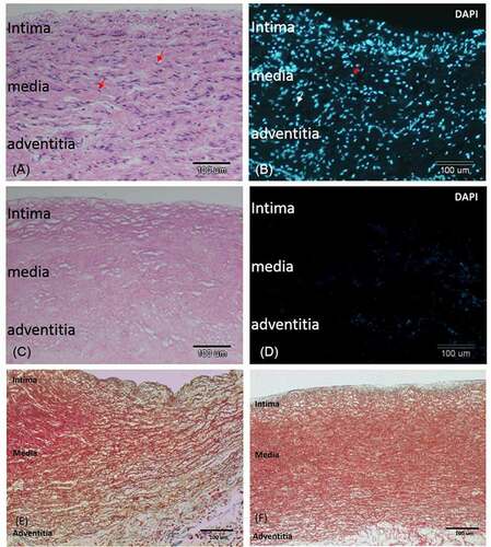 Figure 2. Decellularization removed cells from the pulmonary artery and retained the extracellular matrix. A) H-E-stained section of a non-decellularized porcine pulmonary artery revealing numerous cells in the intima, media, and adventitia. B). Immunofluorescent of nuclei DAPI stain in the same tissue. C) H&E stained section of the same vessel after decellularization. D) DAPI staining of the same section revealing total removal of cell nuclei. E, F) trichrome stain of the vessel before E) and after F) decellularization. The three layers of the vessel remained grossly intact after decellularization: an intact smooth intima, a compact media with red stained smooth muscle fiber, and collagen-rich adventitia and subintimal area. bar = 100 µm.