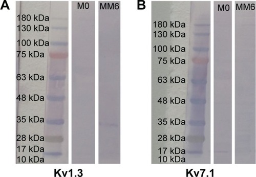 Figure 5 Demonstration of voltage-gated potassium channels in primary cells and the MM6 cells.Notes: Western blot of voltage-gated potassium channels (A) Kv1.3 and (B) Kv7.1 in the leukemic monocyte cell line MM6 and primary monocytes (M0). Primary antibodies used were rabbit anti-Kv1.3 (3 µg/mL; APC-002; Alomone Labs) or rabbit anti-Kv7.1 (4 µg/mL; AB5932; Millipore, Billerica, MA, USA) and a goat anti-rabbit IgG coupled to alkaline phosphatase (50 ng/mL; Abcam). Bound antibody was stained by the NBT/BCIP technique (Sigma-Aldrich Co.).Abbreviations: IgG, immunoglobulin G; NBT/BCIP, nitro-blue tetrazolium chloride/5-bromo-4-chloro-3′-indoylphosphate p-toluidine salt.