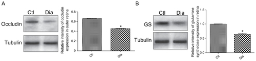 Figure 4 Western blotting analysis and quantification of occludin and GS expression in normal and diabetic conditions. (A) Occludin and tubulin immunoreactivity on protein extracts from OLM region isolated by laser microdissection of outer normal (Ctl) and diabetic (Dia) retina. (B) GS and tubulin immunoreactivity on total protein extracts from normal (Ctl) and diabetic (Dia) retina. These data confirm the expression decrease of both occluding and GS proteins showed by immunochemistry analysis.