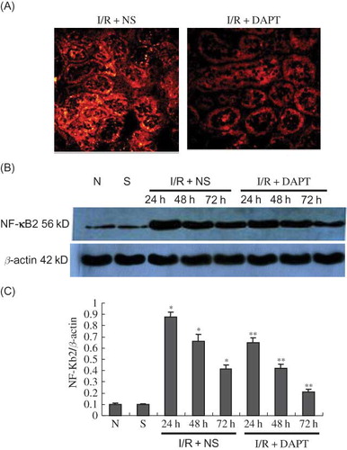 Figure 7. (A) The expression of NF-κB2 in the kidney at 24 h following IRI by immunofluorescence staining (original magnification ×400); renal IRI induced the increase in expression of NF-κB2 protein that translocates into the nucleus; DAPT treatment reduced the expression of NF-κB2 protein. (B) Immunoblot analysis of NF-κB2 protein at 24 h, 48 h, and 72 h of post-reperfusion, respectively. (C) The density of band was quantified. Values presented are ratios of NF-κB2 to β-actin, which was used as an equal protein loading marker. Results are presented as mean ± SEM (n = 5), *p < 0.05 versus sham group.**p < 0.05 versus respective IR + NS at the same time point.