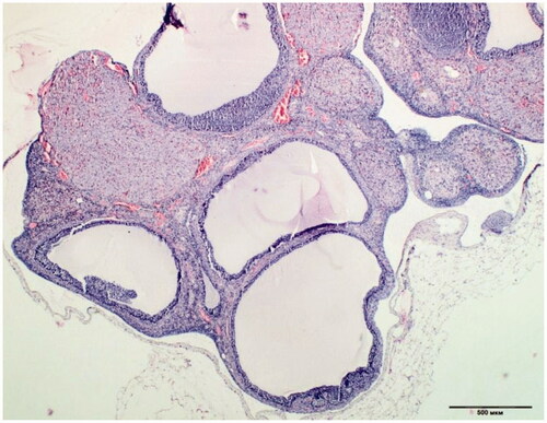 Figure 1. Cystic dilatation of follicles, reduction of granule cell layers in ovary of Wistar rats after letrozole administration. H&E staining, ×500 mcm.