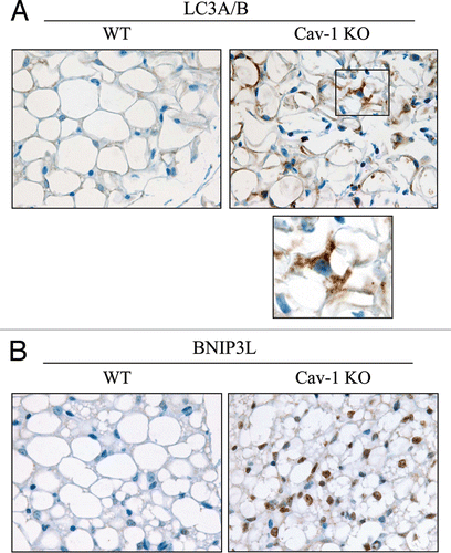 Figure 14 Cav-1 (−/−) null mammary glands exhibit increased autophagy. To monitor autophagy in vivo, paraffin-embedded sections of mammary glands from 5 month old WT and Cav-1 (−/−) null mice were immuno-stained with two markers of autophagy, LC3A/B (A) and BNIP3L (B). Slides were counter-stained with hematoxylin. Note that both LC3A/B and BNIP3L are greatly increased in Cav-1 (−/−) mammary fat pads. The boxed area of LC3A/B staining is shown at higher magnification to better appreciate the LC3 positive vesicles in Cav-1 (−/−) adipocytes. Original magnification, 60x.