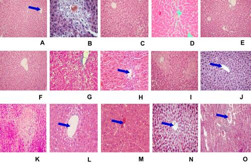 Figure 3 Microphotograph of hematoxylin and eosin (H & E)-stained sections of liver. Micrometer glass slides were prepared in 50 µm intervals.Notes: (A) Negative control (received 2%TW80 only), (B) toxicant control (administered with CCl4 only), (C) positive control (silymarin + CCl4), (D) M100 + CCl4, (E) M200 + CCl4, (F) M400 + CCl4, (G) BF100 + CCl4, (H) BF200 + CCl4, (I) BF400 + CCl4, (J) CF100 + CCl4, (K) CF200 + CCl4, (L) CF400 + CCl4, (M) AF100 + CCl4, (N) AF200 + CCl4, (O) AF400 + CCl4. The blue arrow indicates the central vein. Microphotograph of H & E-stained section of liver from a negative control mouse showing normal histological structure (A, ×10). CCl4-treated mouse liver showing necrosis, infiltration, vacuolization, and disarrangement of hepatocytes (B, ×10). The liver section of the mouse administered crude leaf extract showing nearly normal appearance of hepatocytes (F, ×10), whereas, mice pre- and post-treated with n-butanol fraction showed mild degree of liver damage and inflammatory cell, protection from hepatocyte degradation and centrilobular necrosis (H and I, ×10). Silymarin-treated mouse liver showing normal appearance of hepatocytes (C,×10).