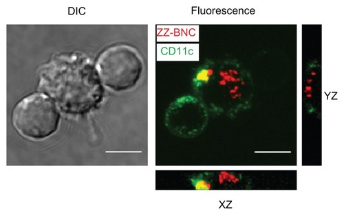 Figure 5 Incorporation of Cy5-labeled α-CD11c (clone N418)-ZZ-BNC complexes by splenic DCs isolated from Cy5-labeled α-DC-ZZ-BNC complex-injected mice.Notes: Z-stack projections of splenic DCs were generated from deconvolved slices using the maximum intensity criteria. Fluorescence derived from ZZ-BNCs and CD11c molecules is indicated in red and green, respectively. Scale bars, 5 μm.Abbreviations: DC, dendritic cell; ZZ-BNC, BNC displaying ZZ domains; DIC, differential interference contrast.