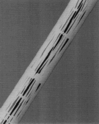 Figure 3. X-rays of the bifurcated AneuRx still in the cartridge. No definitive conclusions related to the structure of the device can be reported.