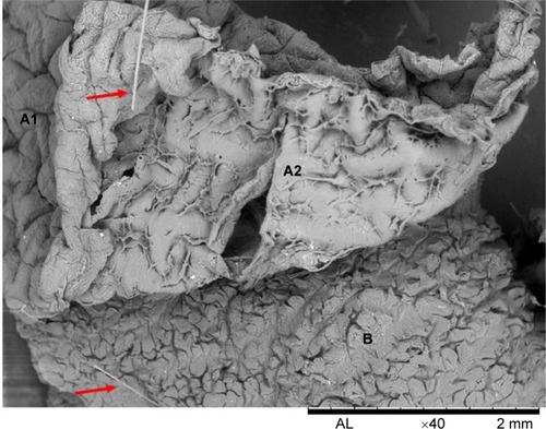 Figure 5 SEM image of skin from donor 2 showing hair (red arrows), epidermis (A1: upper; A2: lower), and dermis (B).Notes: The white spots are micrometric aggregates of silver. The skin was exposed to material 3 for 24 hours.Abbreviation: SEM, scanning electron microscopy.