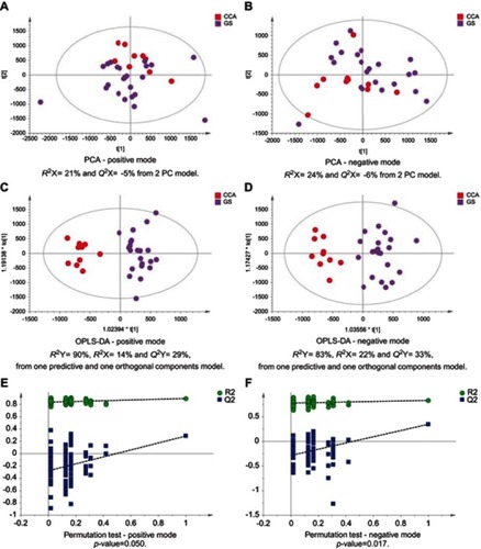 Figure 3 CCA patients vs patients with gallstones. PCA scores plots for (A) positive and (B) negative ion mode data of CCA patients and gallstones cases. OPLS-DA scores plots showing group separation for both (C) positive and (D) negative ion mode data and the corresponding permutation tests for (E) positive and (F) negative ion mode data.