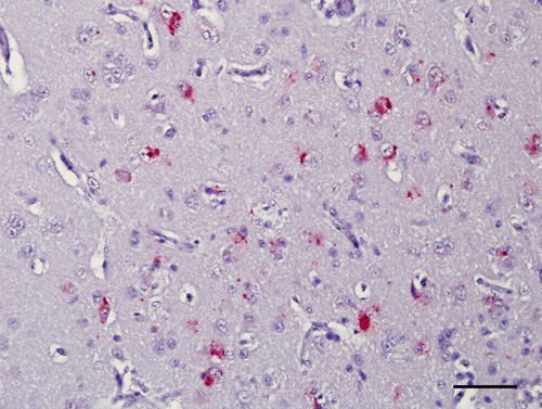 Figure 6.  Hyperpallium, 4-week-old chicken, experimentally infected with Korea 97-147 strain. 5 d.p.i. Immunohistochemistry for viral nucleoprotein (NDV). Multiple granules are identifiable in the cytoplasm of neurons. Bar=50 µm.
