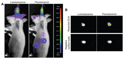 Figure 6 Postresection inspections of the surgical field and the resected lymph nodes and their luminescence and fluorescence images. (A) Postresection evaluation of the surgical field of the same mouse shown in Figures 4 and 5, 3 hours after injection with QD-Luc8 bioconjugates. (B) top: the SLN resected from the mouse shown in (A); bottom: a control lymph node from a mouse without injection with QDs and Luc8. Emission filter was 700 nm. The exposure times for fluorescence and luminescence were 0.1 and 30 seconds, respectively.Abbreviations: Luc8, Renilla reniformis luciferase; SLN, sentinel lymph node; QDs, quantum dots.