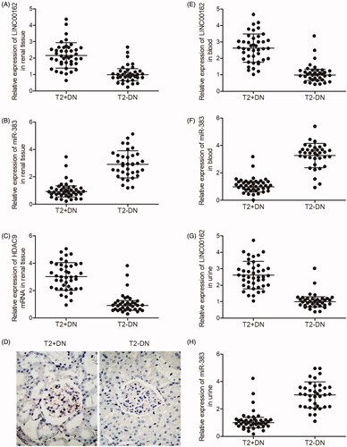 Figure 2. LINC00162, miR-383 and HDAC9 were associated with DN. (A) LINC00162 was highly expressed in kidney tissues obtained from T2D + DN group compared with T2D − DN group. (B) miR-383 level in kidney tissues obtained from the T2D + DN group was much lower than that in samples of the T2D − DN group. (C) HDAC9 mRNA level in kidney tissues obtained from the T2D + DN group was much higher than that in samples of the T2D − DN group. (D) HDAC9 protein level in kidney tissues obtained from the T2D + DN group was evidently increased compared to that in samples of the T2D − DN group. (E) LINC00162 was more strongly expressed in peripheral blood samples obtained from the T2D + DN group compared with that in samples of the T2D − DN group. (F) MiR-383 level in peripheral blood samples obtained from the T2D + DN group was much lower than that in samples of the T2D − DN group. (G) LINC00162 level in urine samples obtained from the T2D + DN group was significantly increased compared to that in samples of the T2D − DN group. (H) miR-383 level in urine samples obtained from the T2D + DN group was apparently decreased compared to that in samples of the T2D − DN group.
