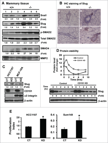 Figure 6. For figure legend, see page 2718.Figure 6 (See previous page). Suppression of the expression and activation of transcription factor Slug and TGF-β signaling by CD151. (A) Expression of Snail and Slug proteins and TGF-β-mediated signaling in mammary tissues. Mammary tissues from 3 individual mice per genotype were blotted with the indicated antibodies. MMP-2 served as a loading control. (B) Representative images of Slug distribution in mammary glands. IHC staining was conducted with tissues from CD151 WT (a, c) or KO (b, d) mice (n = 3). Scale bar: 50 μm. (C) Changes in Slug expression in human mammary epithelial cells upon CD151 ablation. Human mammary epithelial cells (HCC-1187 and SUM-149) with (KD) or without CD151 knockdown (CT) were lysed and blotted for Slug, CD151, α3 integrin and β-actin. (D) Effect of CD151 removal on Slug protein stability. Top panel, Scatter plot of fold changes in Slug protein over time. MCF-10A cells with or without CD151 knockdown were treated with 20 μg/mL cycloheximide over the indicated periods of time and followed by lysing in RIPA buffer and blotting with indicated antibody. (E) Proliferation indices of human mammary progenitor-like epithelial cells (HCC-1187, SUM-149) with (KD) or without CD151 knockdown (CT) over 48 hr period of culture (n = 4). *: P value <0.05. (A–D): Fold changes were calculated on the basis of densitometry measurements.