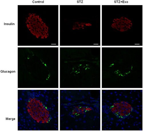 Figure 5 Effect of exosomes (Exo) on islet morphology of low-dose streptozotocin (STZ)-treated mice.