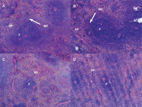 Figure 6 The pathological photos of spleen.Notes: Magnification ×20. (A) The control group. (B) The 5% Glu group. (C and D) The PE group. (C) Represents that the proportion of white pulp is decreased and red pulp is increased. (D) Represents that follicles are markedly reduced in size and poorly demarcated from the marginal zone and the lymphoid sheath.Abbreviations: F, follicle; MZ, marginal zone; RP, red pulp; Glu, glucose injection; PE, PEGylated emulsion.