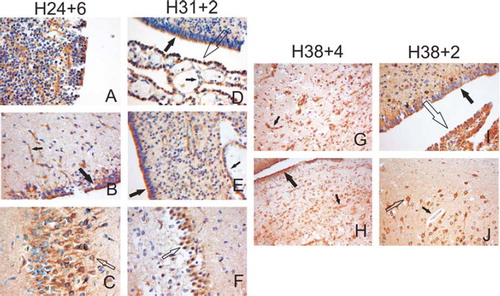 Figure 2. Immunohistochemical localization of CCR3 in the brain. Representative brain samples from preterm (A–F) and term (G–J) infants from different gestational weeks as indicated were stained with anti-CCR3 antibodies. Panel A shows the positive staining in the germinal matrix. Big black arrows indicate the staining in the ependymal cells, small black arrows in the endothelium of the capillaries, small open arrows in the neurons of the hippocampus, and big open arrows in the choroid plexus. Panels G and H represent samples from an infant with long-term asphyxia with remarkable capillary proliferation and an intense CCR3 staining of the endothelia. Panels I and J represent samples from an infant who died from an acute asphyxia. Original magnification in all figures is ×200.