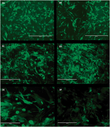 Figure 5. (A,C,E) Representative fluoromicrographs of iASC13EGFP cultured on top of human adipose tissue-derived ECM hydrogels after respectively 1, 6 and 6 days. (B,D,F) Representative fluoromicrographs of iASC13EGFP cultured on tissue culture plastic (control) for respectively 1, 6 and 6 days. Scale bar: A–D: 400 µm, E–F: 200 µm. iASC13EGFP: immortalized EGFP-tagged adipose derived stromal cells; ECM: extracellular matrix.